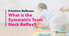 What is the Symmetric Tonic Neck Reflex?